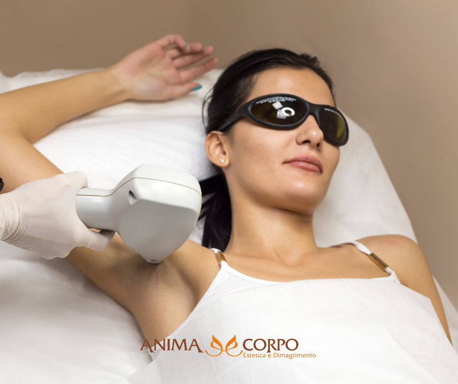 epilazione laser